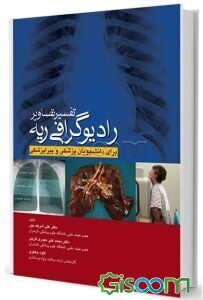 تفسیر تصاویر رادیوگرافی ریه برای دانشجویان پزشکی و پیراپزشکی