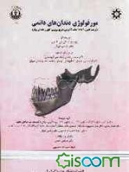 مورفولوژی دندان‌های دائمی (ترجمه فصول 6 تا 12 کتاب آناتومی، فیزیولوژی و اکلوژن دندانی ویلر)