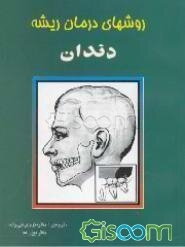 روشهای درمان ریشه دندان