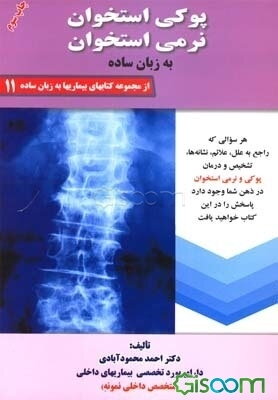پوکی استخوان، نرمی استخوان: به زبان ساده