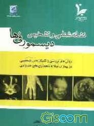 نشانه‌شناسی و تشخیص دیسمورفی‌ها: روشهای بررسی و تکنیک‌های تشخیصی در بیماران مبتلا به ناهنجاری‌های مادرزادی