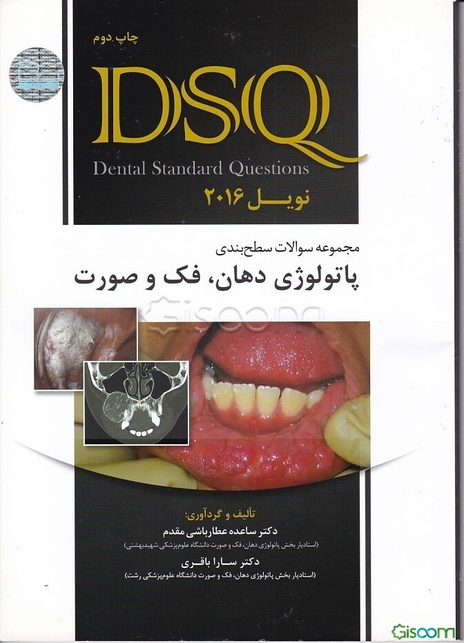 پاتولوژی دهان و فک و صورت نویل