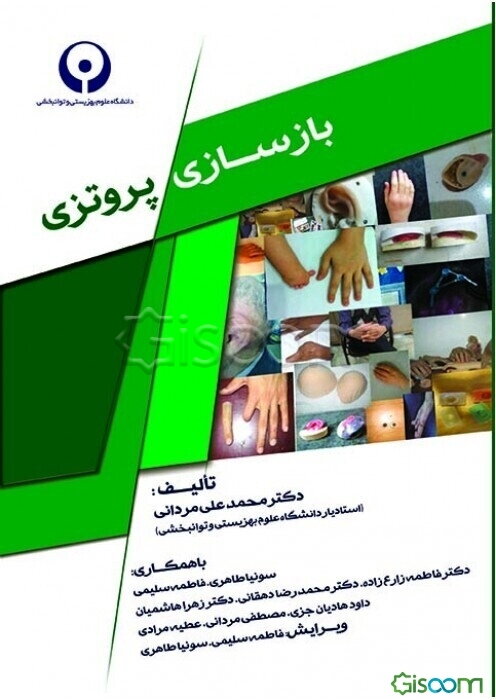 بازسازی پروتزی