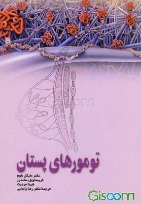 پیشگیری و درمان تومورهای پستان