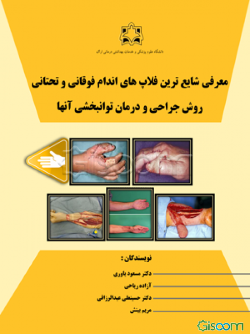 معرفی شایع ترین فلاپ‌های اندام فوقانی و تحتانی: روش جراحی و درمان توانبخشی آنها