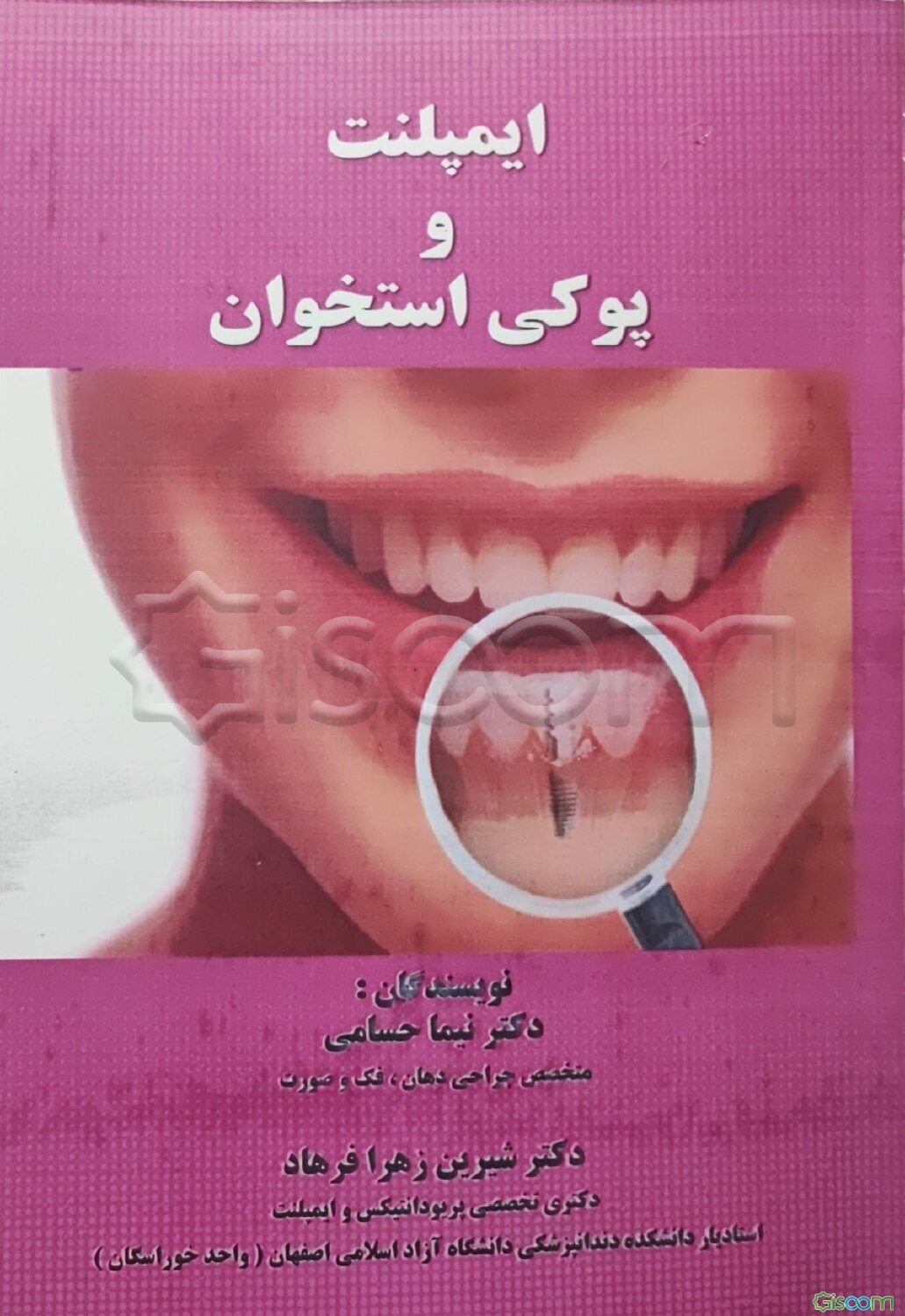 ایمپلنت و پوکی استخوان