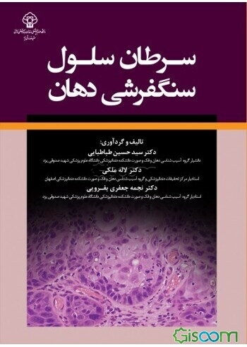 سرطان سلول سنگفرشی دهان