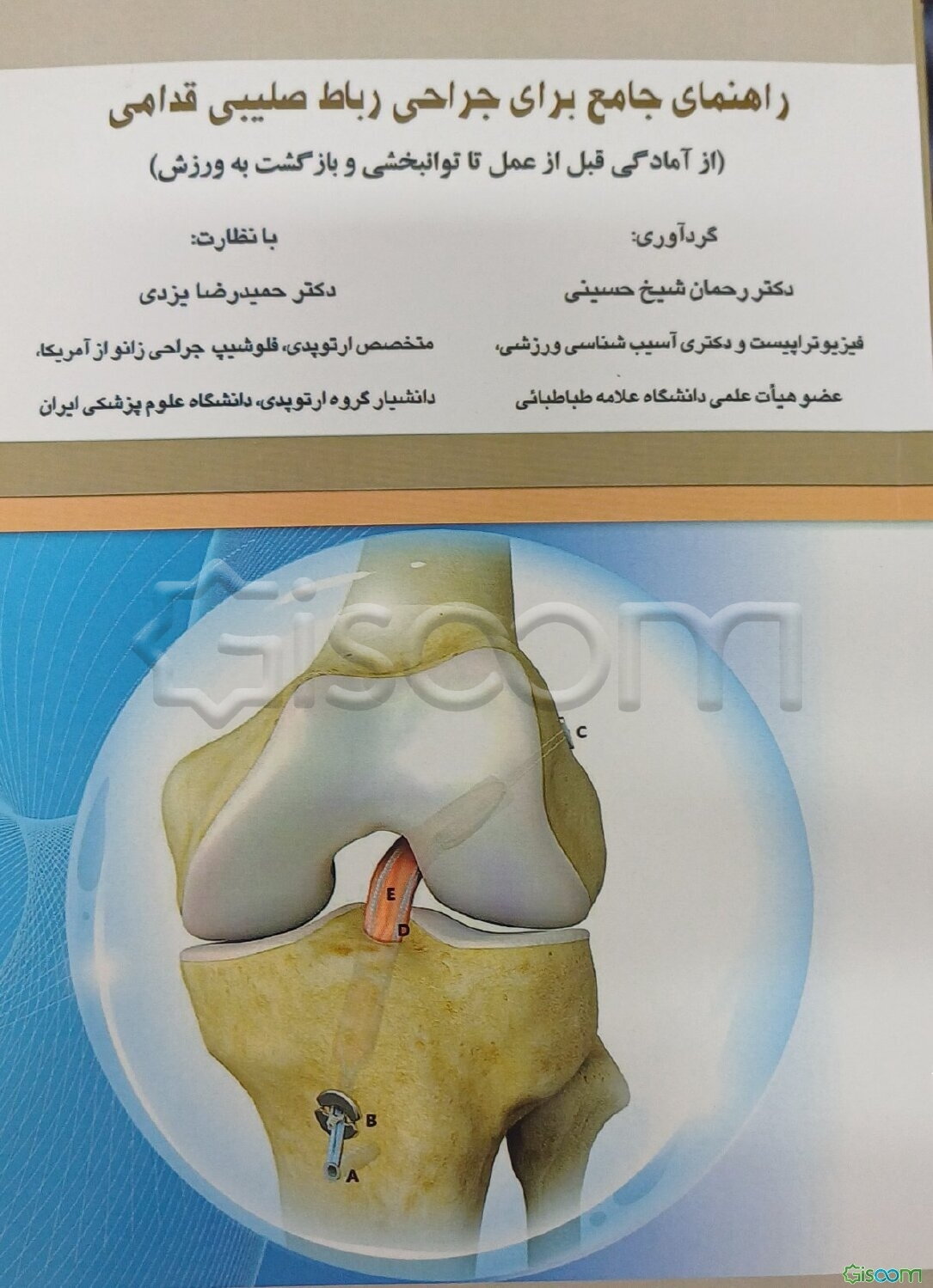 راهنمای جامع بیماران برای جراحی رباط صلیبی قدامی (از آمادگی قبل از عمل تا توانبخشی و بازگشت به زندگی)