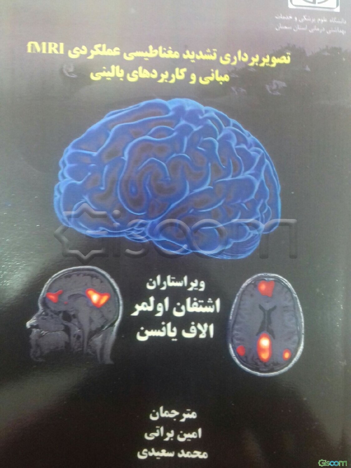تصویربرداری تشدید مغناطیسی عملکردی fMRI: مبانی و کاربردهای بالینی