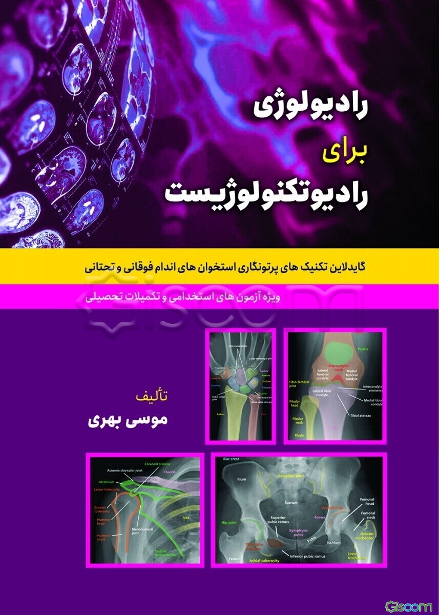 رادیولوژی برای رادیوتکنولوژیست: گایدلاین تکنیک‌های پرتونگاری استخوان‌های اندام فوقانی و تحتانی ...