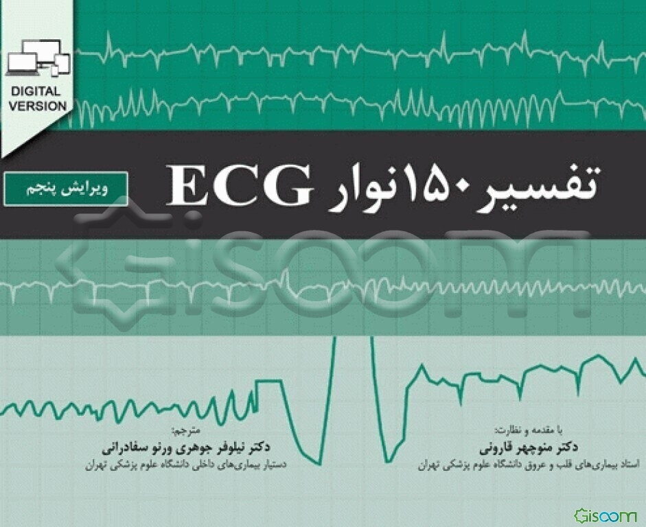 تفسیر 150 نوار ECG