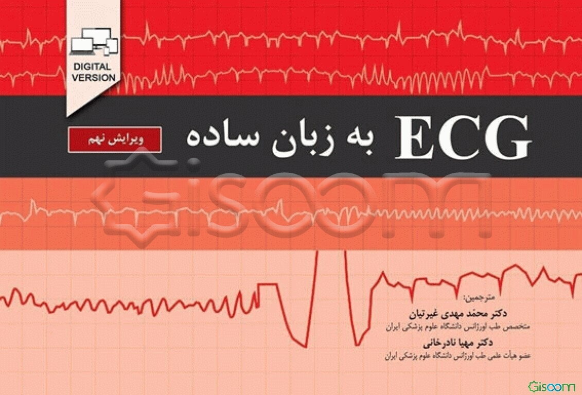 ECG به زبان ساده