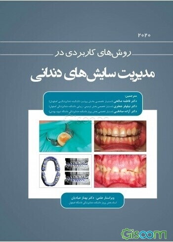 روش‌های کاربردی در مدیریت سایش‌های دندانی (2020)