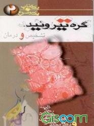 گره تیروئید: تشخیص و درمان