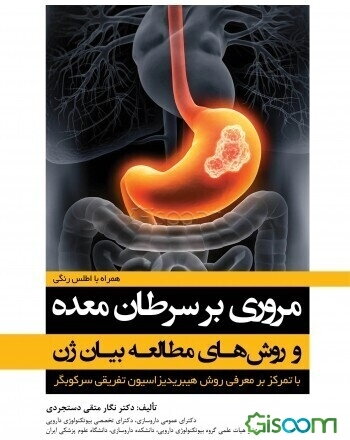 مروری بر سرطان معده و روش‌های مطالعه بیان ژن: با تمرکز بر معرفی روش هیبریدیزاسیون تفریقی سرکوبگر همراه با اطلس رنگی