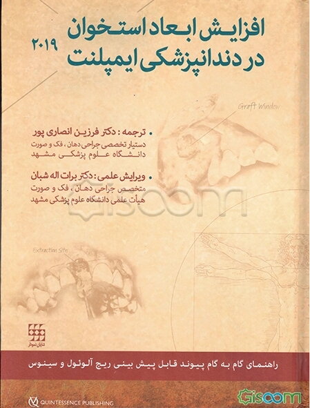 افزایش ابعاد استخوان در دندانپزشکی ایمپلنت 2019