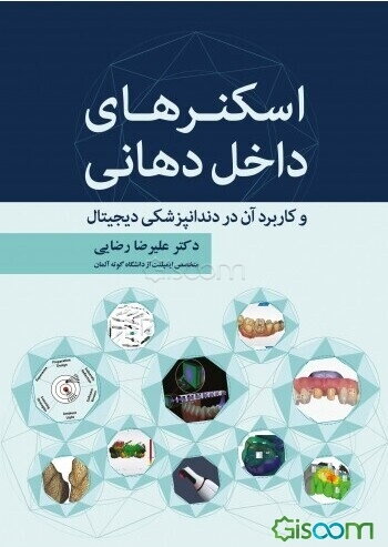 اسکنرهای داخل دهانی و کاربرد آن در دندانپزشکی دیجیتال