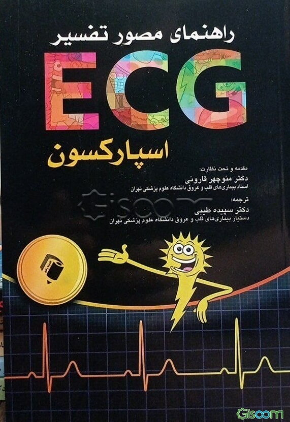 راهنمای مصور تفسیر ECG اسپارکسون