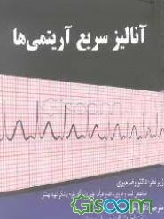 آنالیز سریع آریتمی‌ها