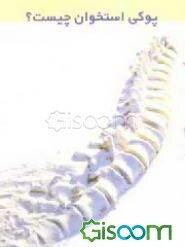 پوکی استخوان چیست؟