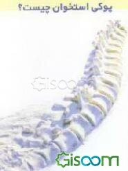 پوکی استخوان چیست؟