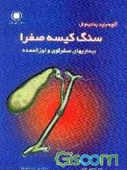 آنچه باید بدانیم از: سنگ کیسه صفرا، بیماریهای صفراوی و لوزالمعده