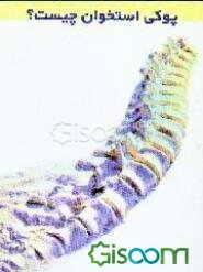 پوکی استخوان چیست؟