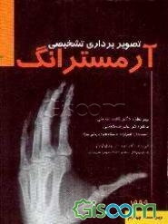 تصویربرداری تشخیصی آرمسترانگ