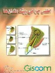 اطلس جراحی ریشه دندان‌ها