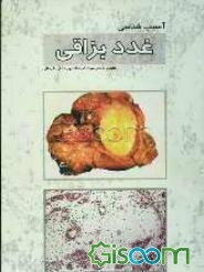 آسیب‌شناسی غدد بزاقی