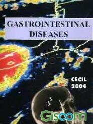 Gastrointestinal diseases