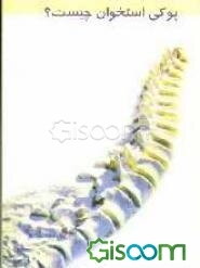 پوکی استخوان چیست؟