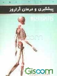 پیشگیری و درمان آرتروز