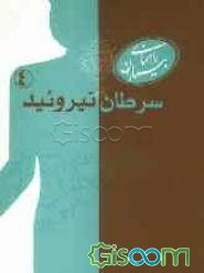 سرطان تیروئید