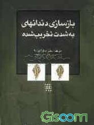 بازسازی دندان‌های به‌شدت تخریب شده