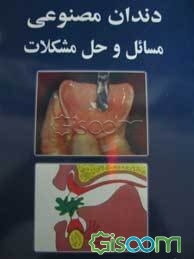 دندان مصنوعی: مسائل و حل مشکلات