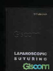 Laparoscopic suturing
