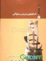 اسکولیوز و بریس میلواکی