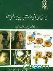 بیماریهای ناشی از سوء تغذیه و اپیدمیولوژی آنها