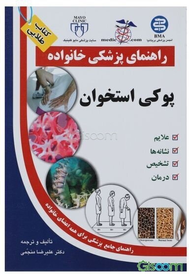 پوکی استخوان (اوستئوپورز)