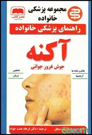 آکنه (جوش غرور جوانی)