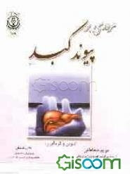 مروری بر پیوند کبد