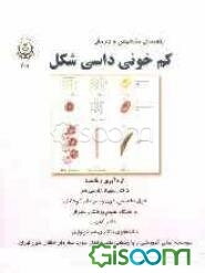راهنمای تشخیص و درمان کم‌خونی داسی شکل
