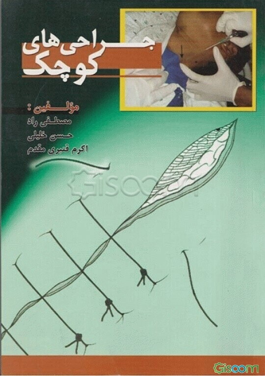 جراحی‌های کوچک