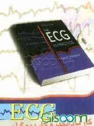 کاربرد الکتروکاردیوگرام ECG