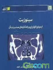 سینوزیت: ایمونوپاتولوژی و راهکارهای مدیریت آن