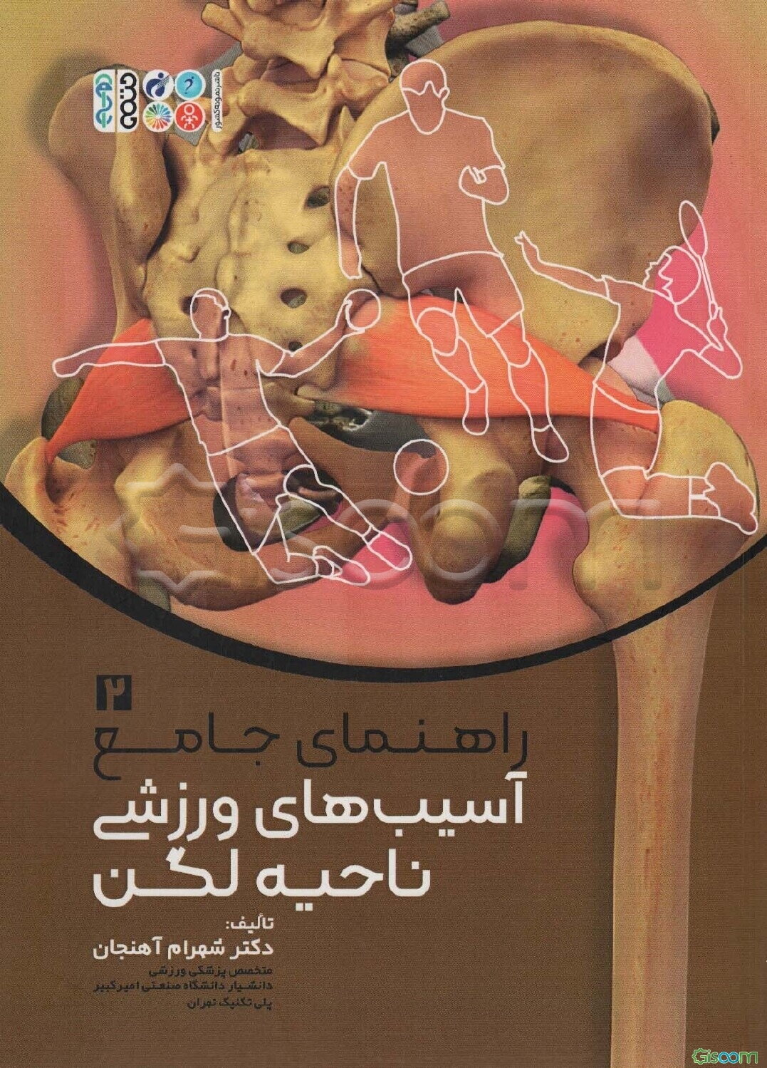 راهنمای جامع آسیب‌های ورزشی: ناحیه لگن  (2)