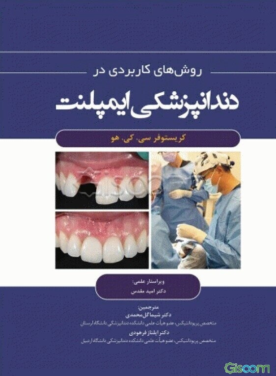 روش‌های کاربردی در دندانپزشکی ایمپلنت