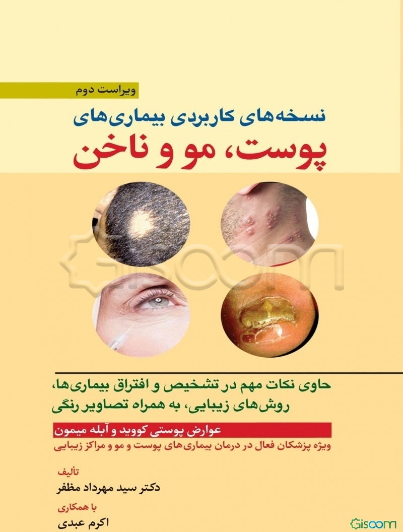 نسخه‌های کاربردی بیماری‌های پوست، مو و ناخن: حاوی نکات مهم در تشخیص و افتراق بیماری‌ها، روش‌های زیبایی، به همراه تصاویر رنگی ...