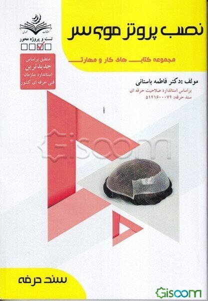 نصب پروتز موی سر